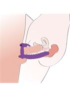 Фиолетовая насадка на пенис для анальной стимуляции партнёрши